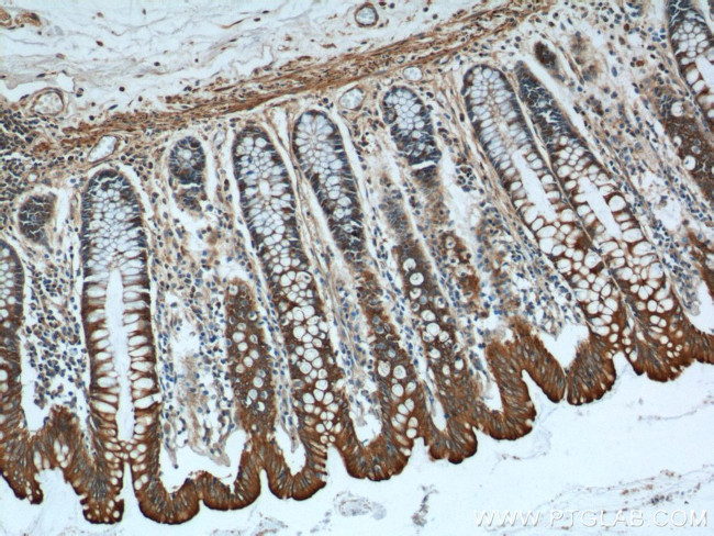 Cytokeratin 8 Antibody in Immunohistochemistry (Paraffin) (IHC (P))