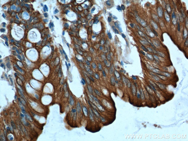 Cytokeratin 8 Antibody in Immunohistochemistry (Paraffin) (IHC (P))