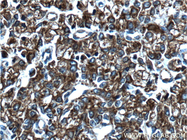 Cytokeratin 8 Antibody in Immunohistochemistry (Paraffin) (IHC (P))