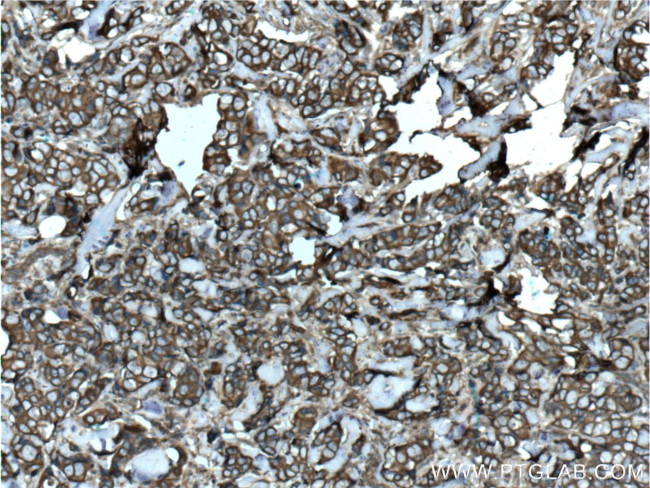 Cytokeratin 8 Antibody in Immunohistochemistry (Paraffin) (IHC (P))