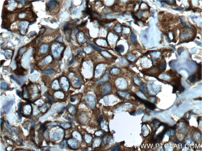 Cytokeratin 8 Antibody in Immunohistochemistry (Paraffin) (IHC (P))