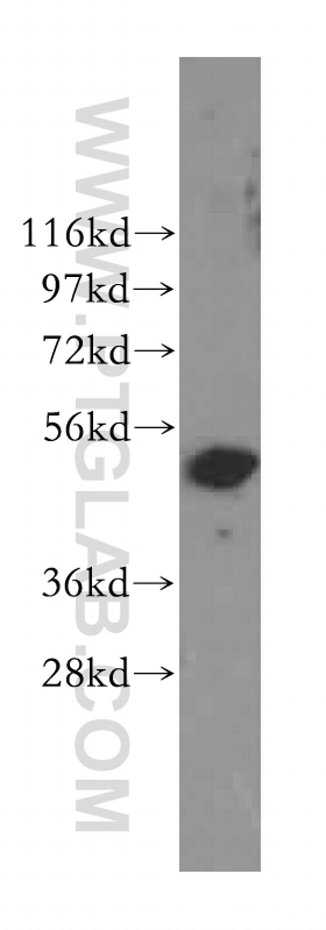 Cytokeratin 8 Antibody in Western Blot (WB)