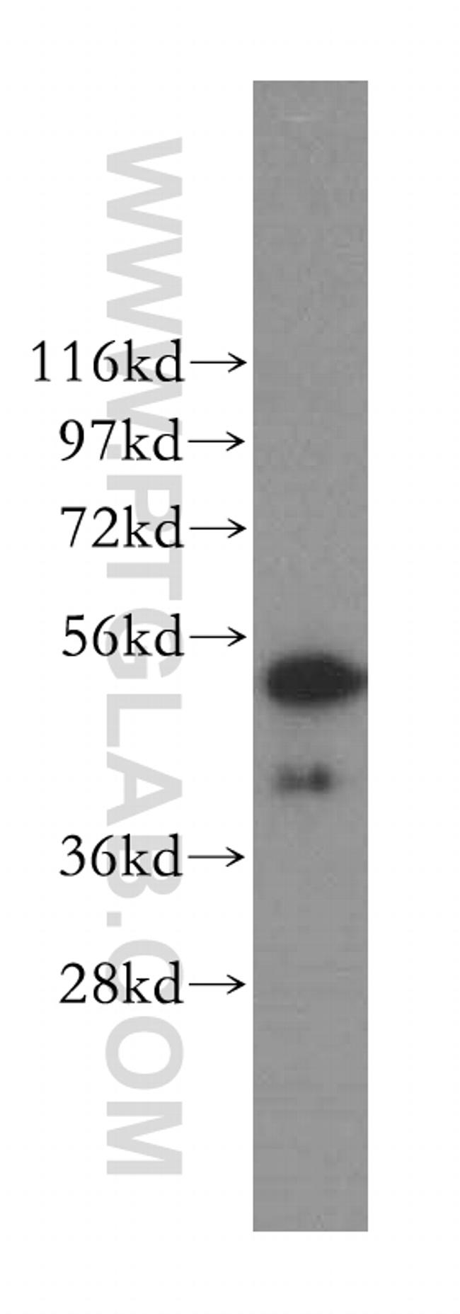 Cytokeratin 8 Antibody in Western Blot (WB)