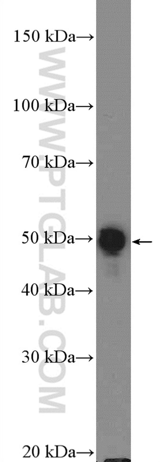 Cytokeratin 8 Antibody in Western Blot (WB)