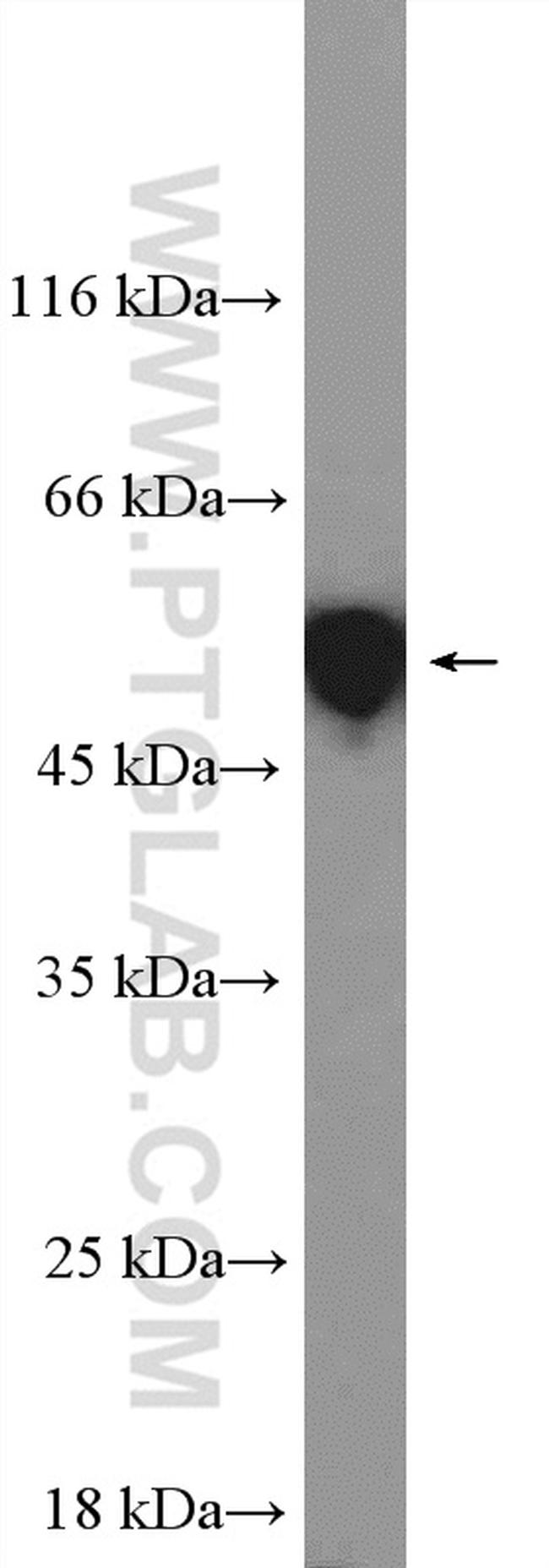 Cytokeratin 8 Antibody in Western Blot (WB)