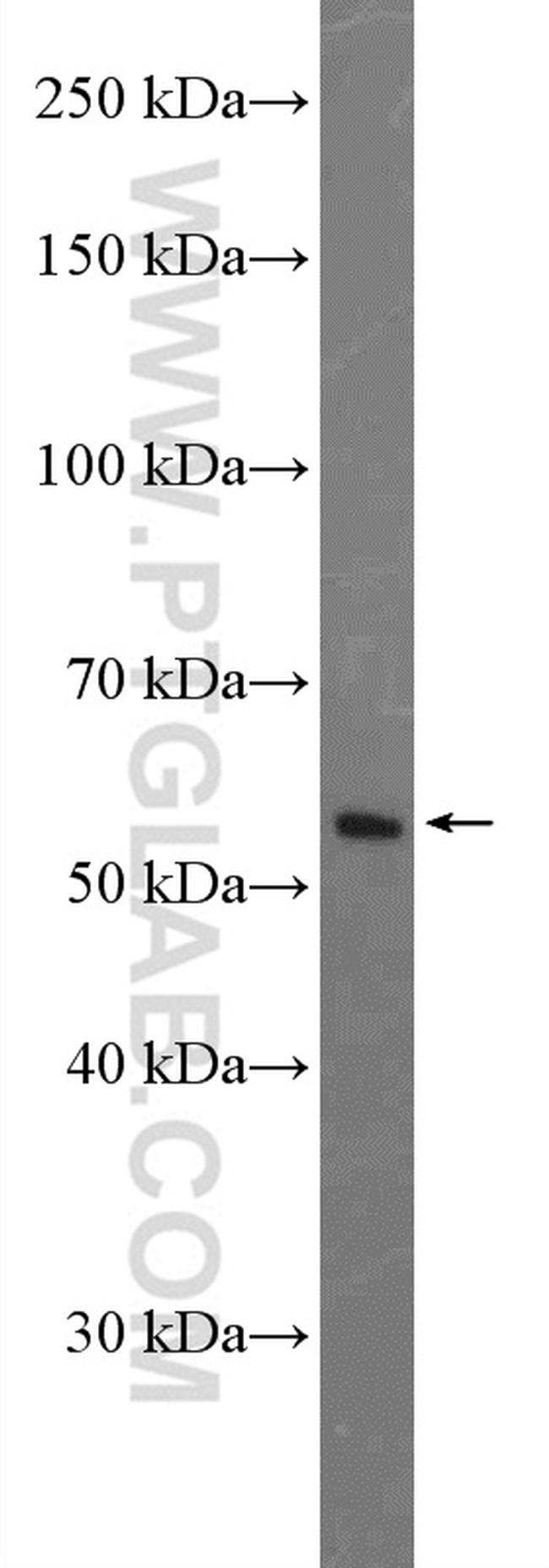 Cytokeratin 8 Antibody in Western Blot (WB)