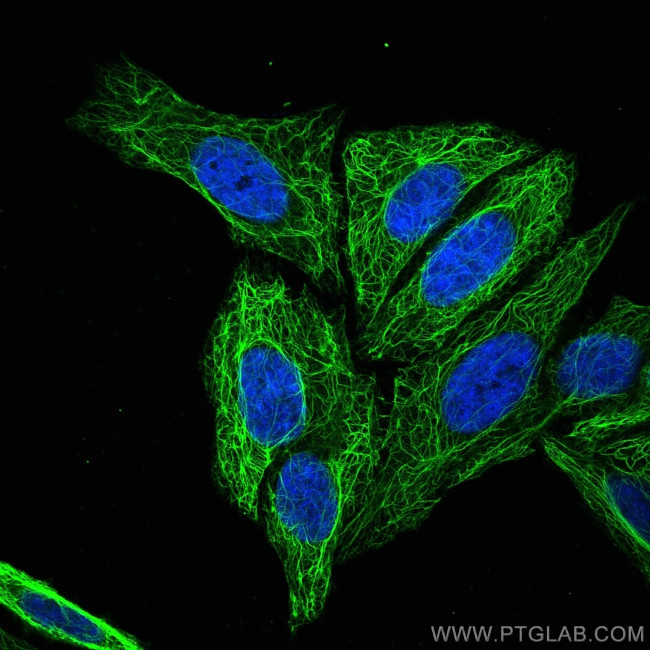 Cytokeratin 17 Antibody in Immunocytochemistry (ICC/IF)