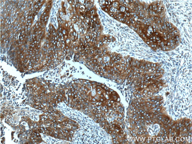 Cytokeratin 17 Antibody in Immunohistochemistry (Paraffin) (IHC (P))