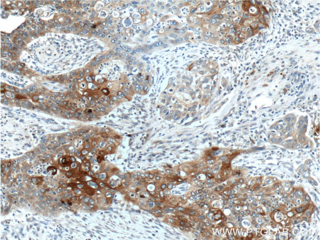 Cytokeratin 17 Antibody in Immunohistochemistry (Paraffin) (IHC (P))