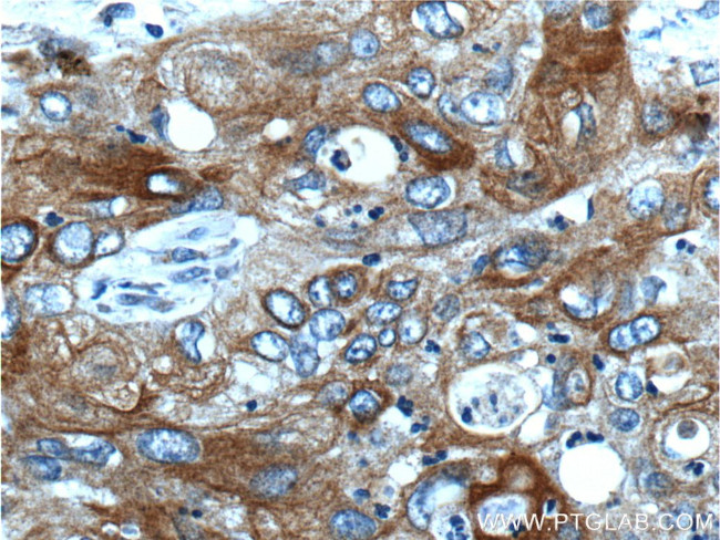 Cytokeratin 17 Antibody in Immunohistochemistry (Paraffin) (IHC (P))