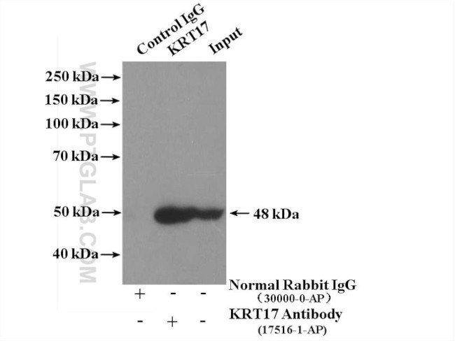 Cytokeratin 17 Antibody in Immunoprecipitation (IP)