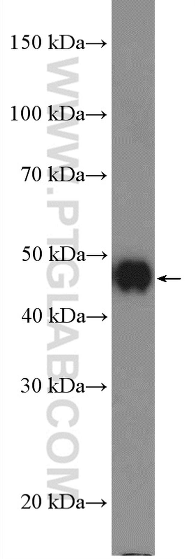 Cytokeratin 17 Antibody in Western Blot (WB)