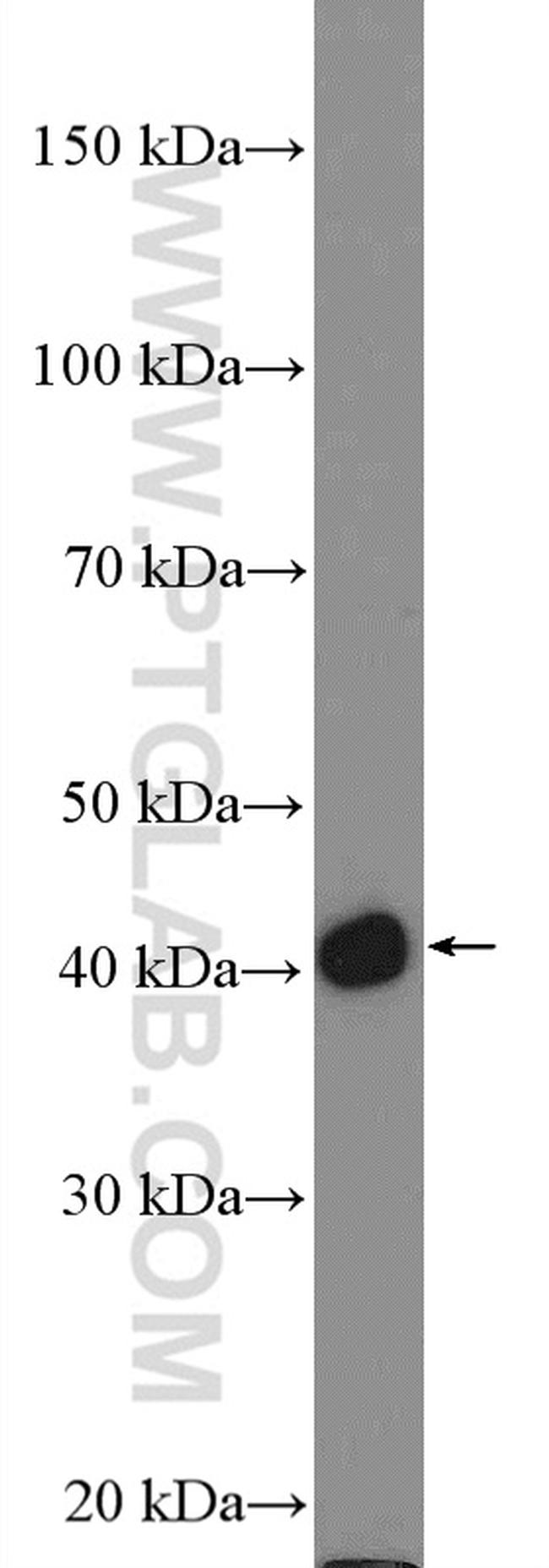 Cytokeratin 17 Antibody in Western Blot (WB)