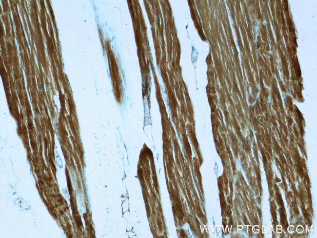 ACTA1 Antibody in Immunohistochemistry (Paraffin) (IHC (P))