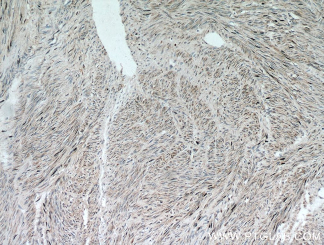 ACTA1 Antibody in Immunohistochemistry (Paraffin) (IHC (P))