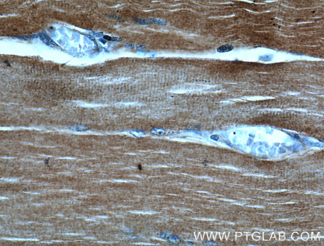 ACTA1 Antibody in Immunohistochemistry (Paraffin) (IHC (P))