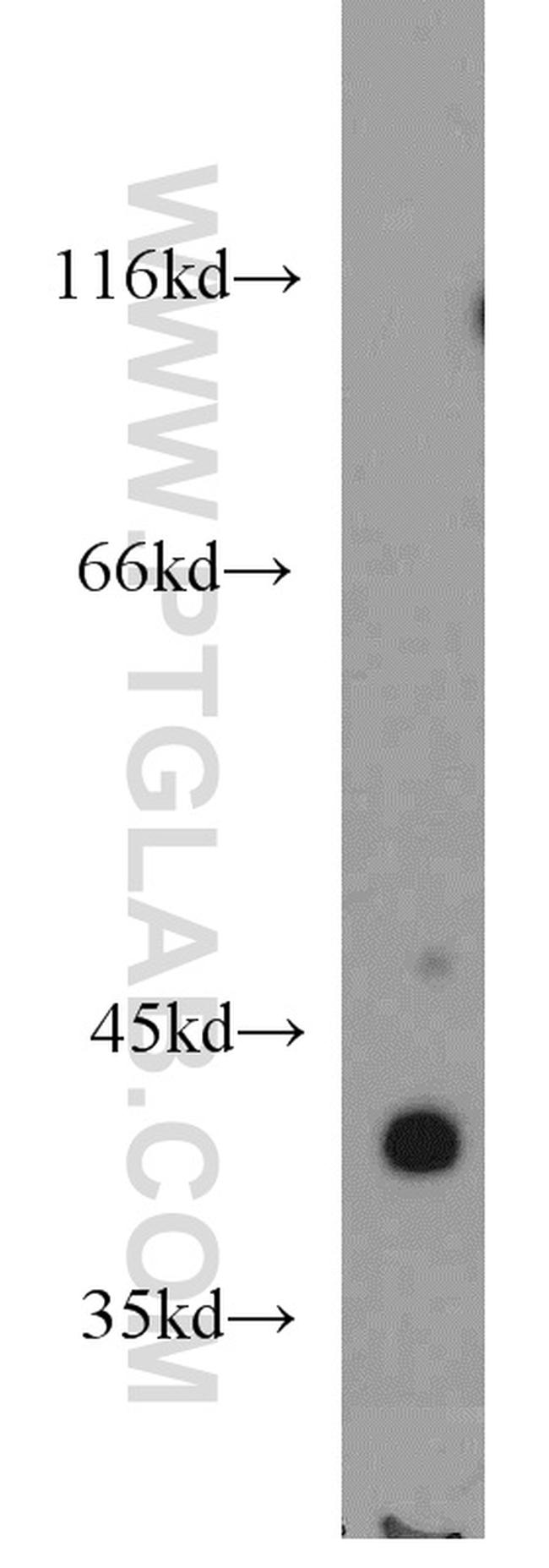 ACTA1 Antibody in Western Blot (WB)