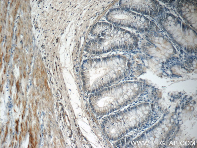 ACADL Antibody in Immunohistochemistry (Paraffin) (IHC (P))