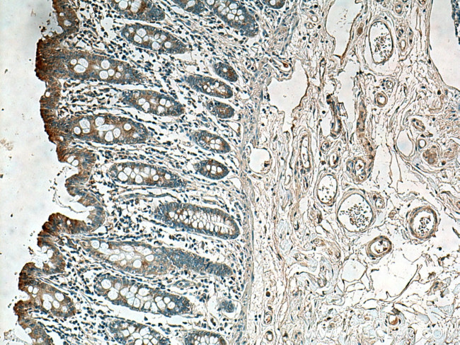 ACADL Antibody in Immunohistochemistry (Paraffin) (IHC (P))