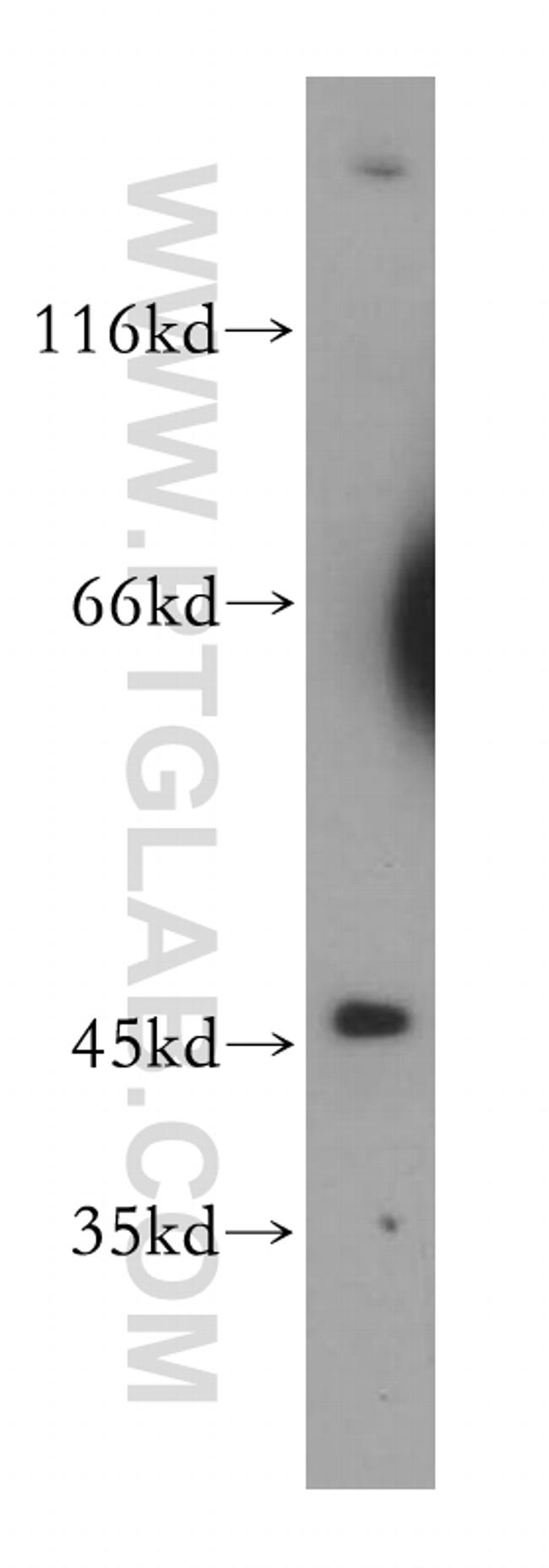 ACADL Antibody in Western Blot (WB)