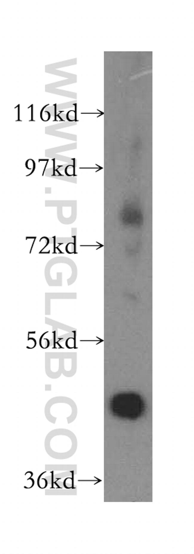 ACADL Antibody in Western Blot (WB)