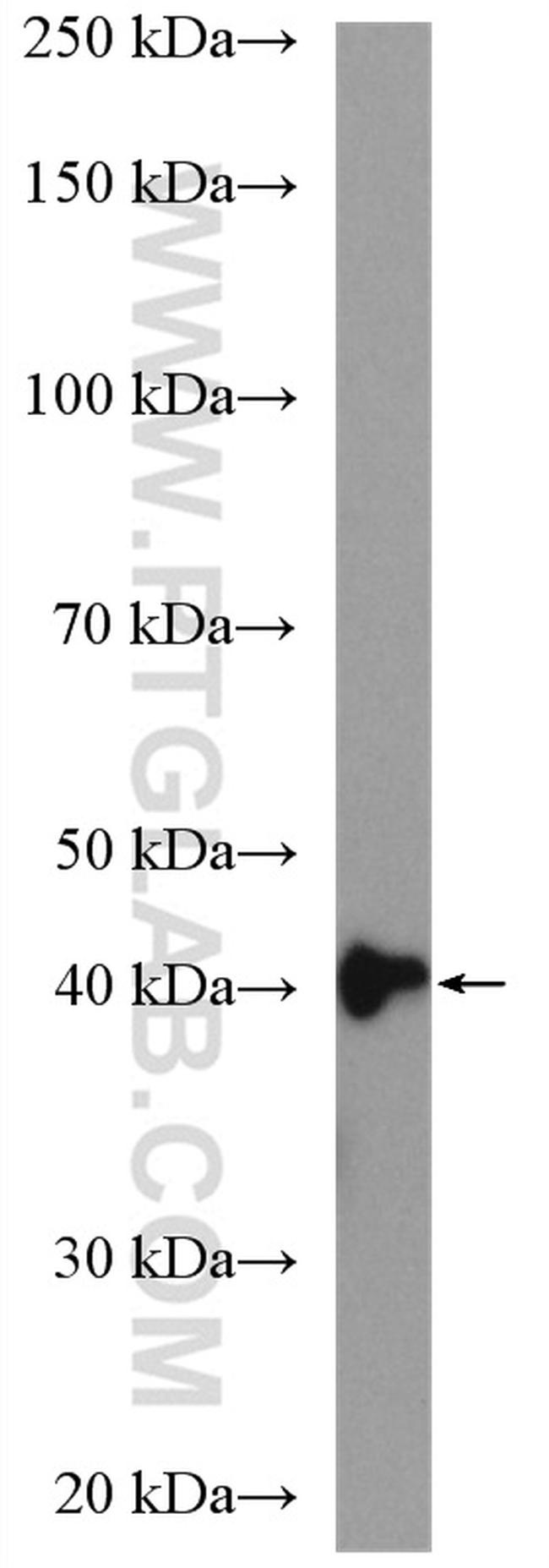 ACADL Antibody in Western Blot (WB)