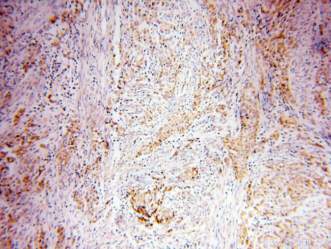 CTDSPL2 Antibody in Immunohistochemistry (Paraffin) (IHC (P))