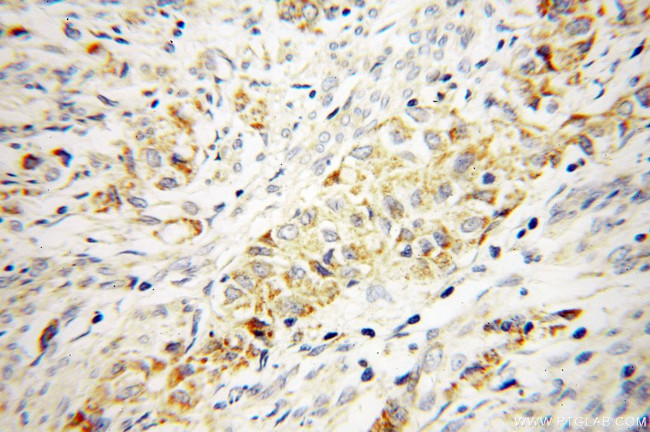 CTDSPL2 Antibody in Immunohistochemistry (Paraffin) (IHC (P))