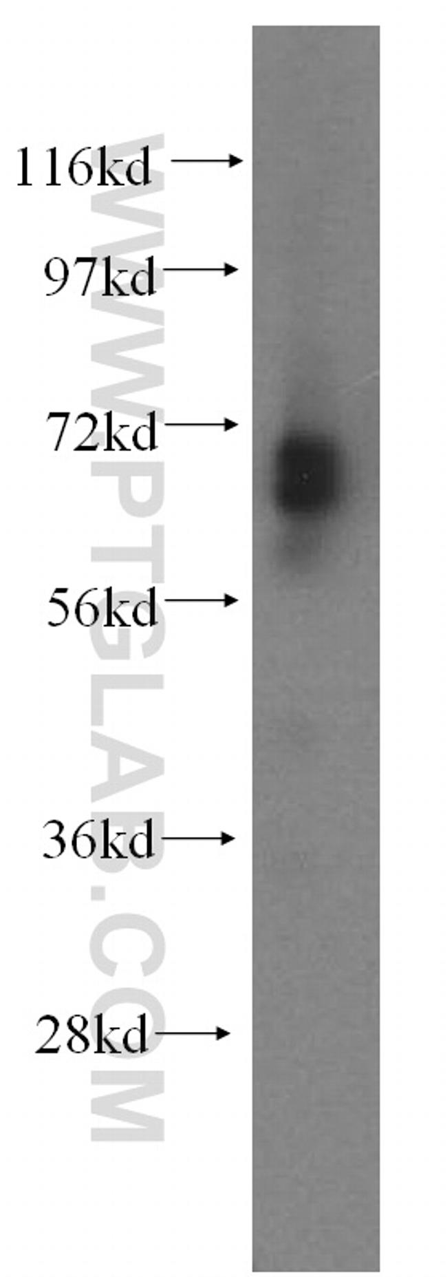 CTDSPL2 Antibody in Western Blot (WB)