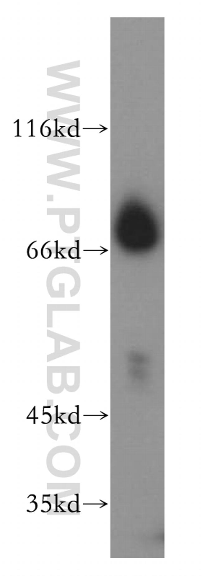 CTDSPL2 Antibody in Western Blot (WB)