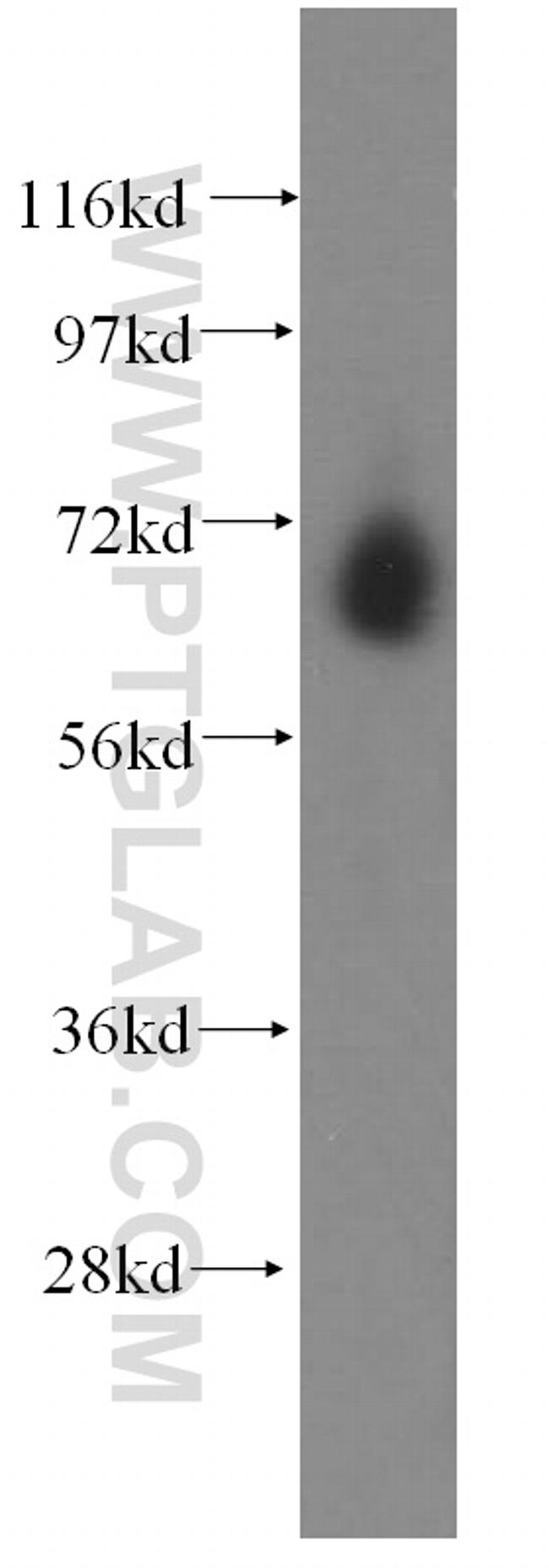 CTDSPL2 Antibody in Western Blot (WB)