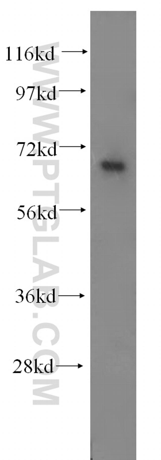 CTDSPL2 Antibody in Western Blot (WB)