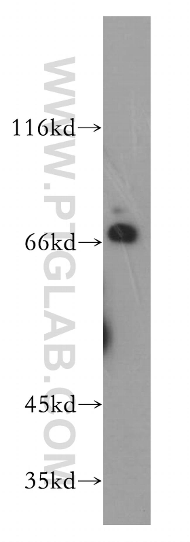 CTDSPL2 Antibody in Western Blot (WB)