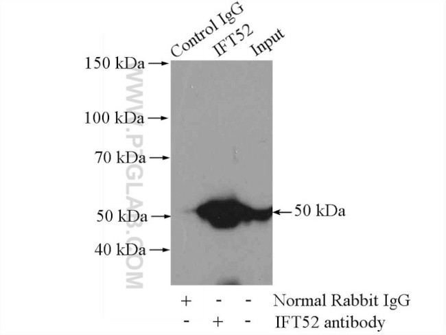 IFT52 Antibody in Immunoprecipitation (IP)