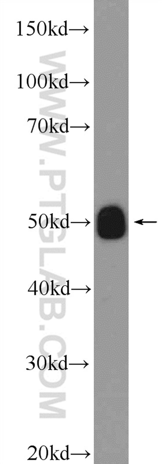 IFT52 Antibody in Western Blot (WB)