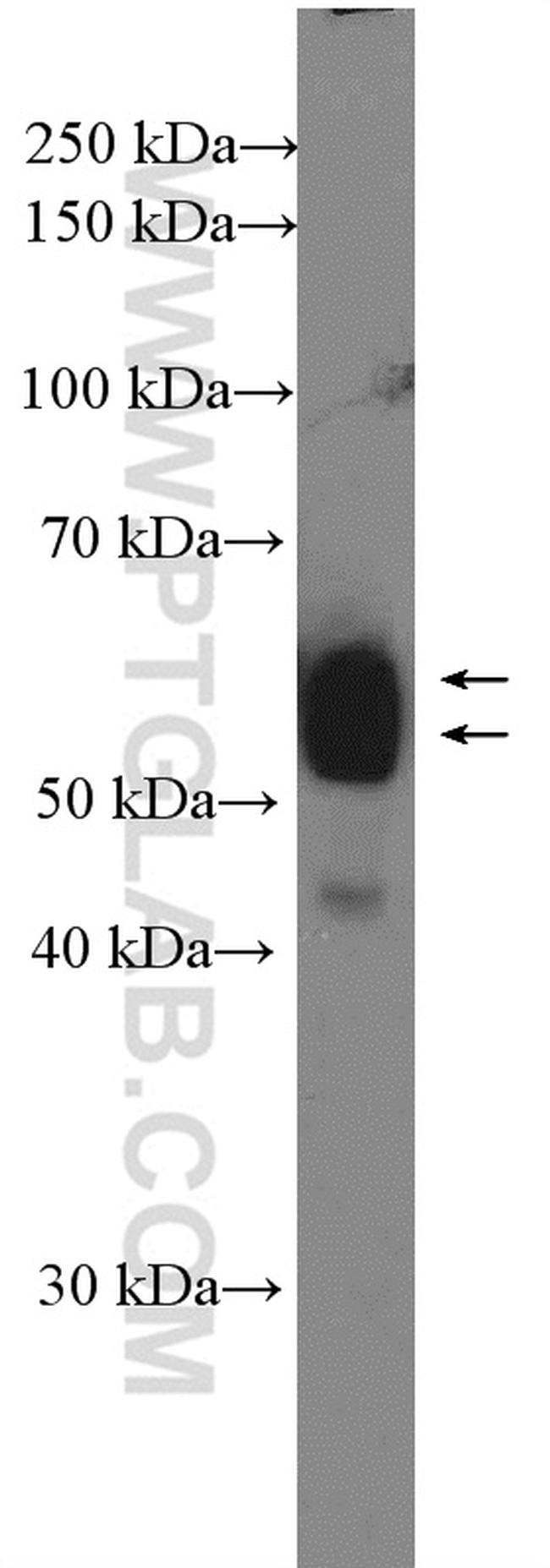 EARS2 Antibody in Western Blot (WB)