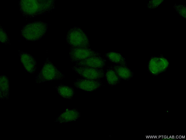 HDAC8 Antibody in Immunocytochemistry (ICC/IF)