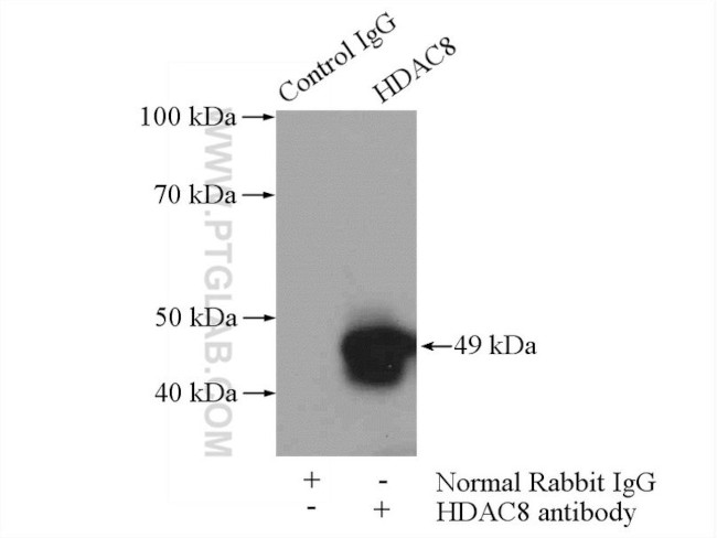 HDAC8 Antibody in Immunoprecipitation (IP)