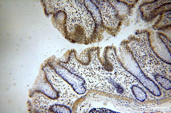 MTA2 Antibody in Immunohistochemistry (Paraffin) (IHC (P))