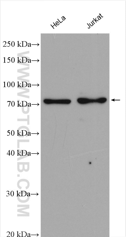 MTA2 Antibody in Western Blot (WB)