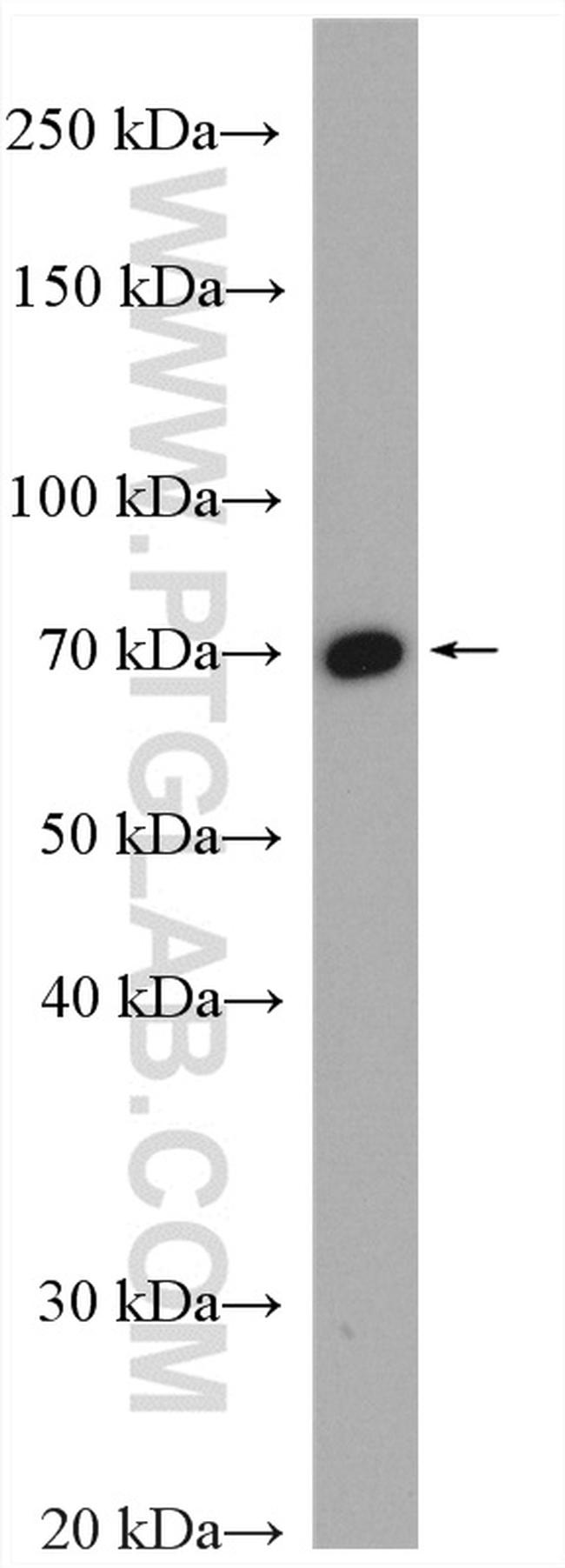 MTA2 Antibody in Western Blot (WB)