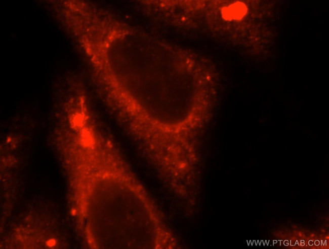 TRMT11 Antibody in Immunocytochemistry (ICC/IF)