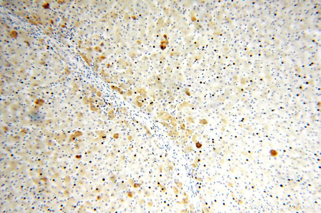 TRMT11 Antibody in Immunohistochemistry (Paraffin) (IHC (P))