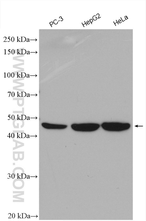 TRMT11 Antibody in Western Blot (WB)