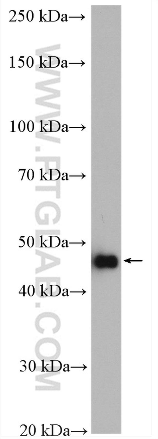 TRMT11 Antibody in Western Blot (WB)