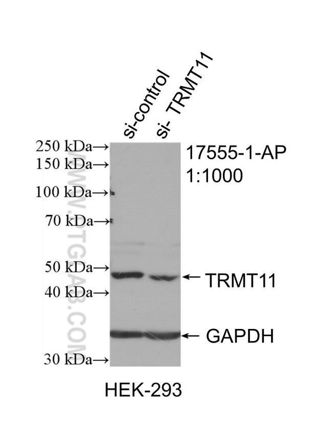 TRMT11 Antibody in Western Blot (WB)