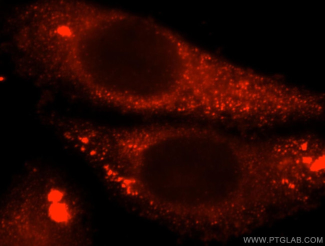 Calpain 9 Antibody in Immunocytochemistry (ICC/IF)