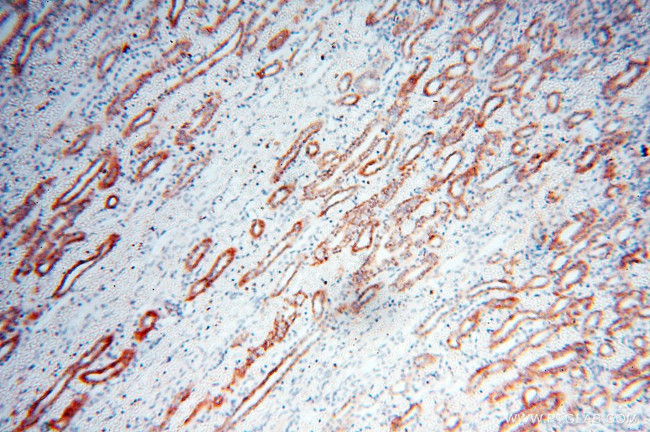 Calpain 9 Antibody in Immunohistochemistry (Paraffin) (IHC (P))