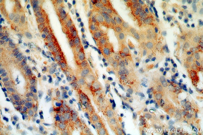 Calpain 9 Antibody in Immunohistochemistry (Paraffin) (IHC (P))