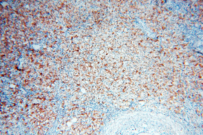 Calpain 9 Antibody in Immunohistochemistry (Paraffin) (IHC (P))